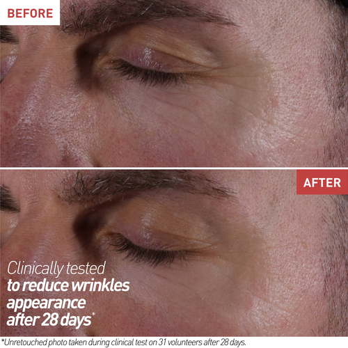 view 9/9 of Skin Therapy Eye, , US